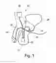 Fig. 02 - Urethra cuff including tube