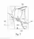 Fig. 10 - Urethra cuff including tube