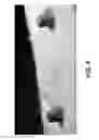 Fig. 09 - Elongated tissue matrices