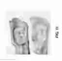 Fig. 12 - Elongated tissue matrices
