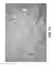 Fig. 14 - Elongated tissue matrices