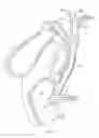 Fig. 02 - BILIARY STENTS AND METHODS