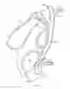 Fig. 03 - BILIARY STENTS AND METHODS