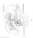 Fig. 09 - BILIARY STENTS AND METHODS