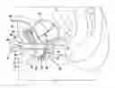 Fig. 01 - Urinary flow control device and method