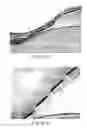 Fig. 07 - Metallic implantable grafts and method of making same