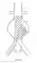 Fig. 08 - Devices and methods for treatment of vascular aneurysms