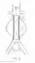 Fig. 14 - Devices and methods for treatment of vascular aneurysms