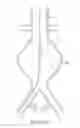 Fig. 23 - Devices and methods for treatment of vascular aneurysms
