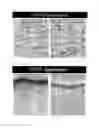 Fig. 06 - PATCH-TYPE ARTIFICIAL SKIN PREPARATION