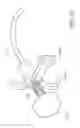 Fig. 21 - Delivery system for vascular implant