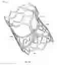 Fig. 03 - Collapsible prosthetic heart valves
