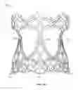 Fig. 05 - Collapsible prosthetic heart valves