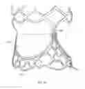 Fig. 06 - Collapsible prosthetic heart valves