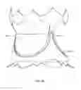 Fig. 07 - Collapsible prosthetic heart valves