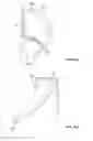 Fig. 20 - Collapsible prosthetic heart valves