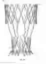 Fig. 30 - Collapsible prosthetic heart valves