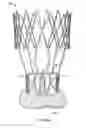 Fig. 34 - Collapsible prosthetic heart valves