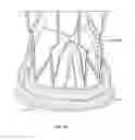 Fig. 42 - Collapsible prosthetic heart valves