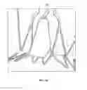 Fig. 44 - Collapsible prosthetic heart valves