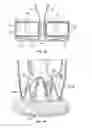 Fig. 46 - Collapsible prosthetic heart valves