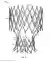 Fig. 48 - Collapsible prosthetic heart valves