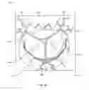 Fig. 52 - Collapsible prosthetic heart valves