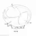 Fig. 53 - Collapsible prosthetic heart valves