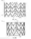 Fig. 65 - Collapsible prosthetic heart valves