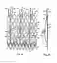 Fig. 02 - Low profile heart valve and delivery system