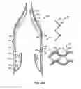Fig. 05 - Low profile heart valve and delivery system