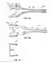Fig. 07 - Low profile heart valve and delivery system