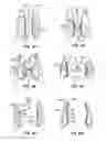 Fig. 24 - Low profile heart valve and delivery system