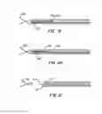 Fig. 32 - Low profile heart valve and delivery system