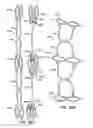 Fig. 44 - Low profile heart valve and delivery system