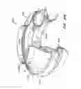 Fig. 47 - Low profile heart valve and delivery system