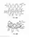 Fig. 51 - Low profile heart valve and delivery system