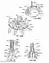 Fig. 63 - Low profile heart valve and delivery system