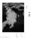 Fig. 07 - Milled bone graft materials and methods of use