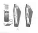 Fig. 02 - Shape-memory-actuated materials for accelerated healing of orthopedic injuries