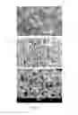 Fig. 07 - Shape-memory-actuated materials for accelerated healing of orthopedic injuries