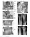 Fig. 05 - MENISCUS FOR JOINT RECONSTRUCTION