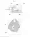Fig. 07 - MENISCUS FOR JOINT RECONSTRUCTION