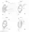 Fig. 08 - MENISCUS FOR JOINT RECONSTRUCTION