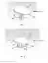 Fig. 03 - Partial joint resurfacing implant, instrumentation, and method