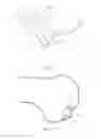 Fig. 07 - Partial joint resurfacing implant, instrumentation, and method