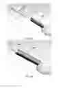 Fig. 13 - Partial joint resurfacing implant, instrumentation, and method