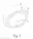 Fig. 04 - Constrained mobile bearing hip assembly