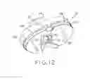Fig. 07 - Tibial prosthesis with a fixed bearing component