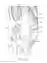 Fig. 14 - Tibial prosthesis with a fixed bearing component